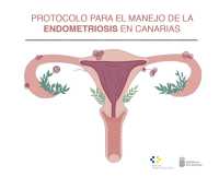 Sanidad registra a más de 12.000 mujeres diagnosticadas de endometriosis en Canarias